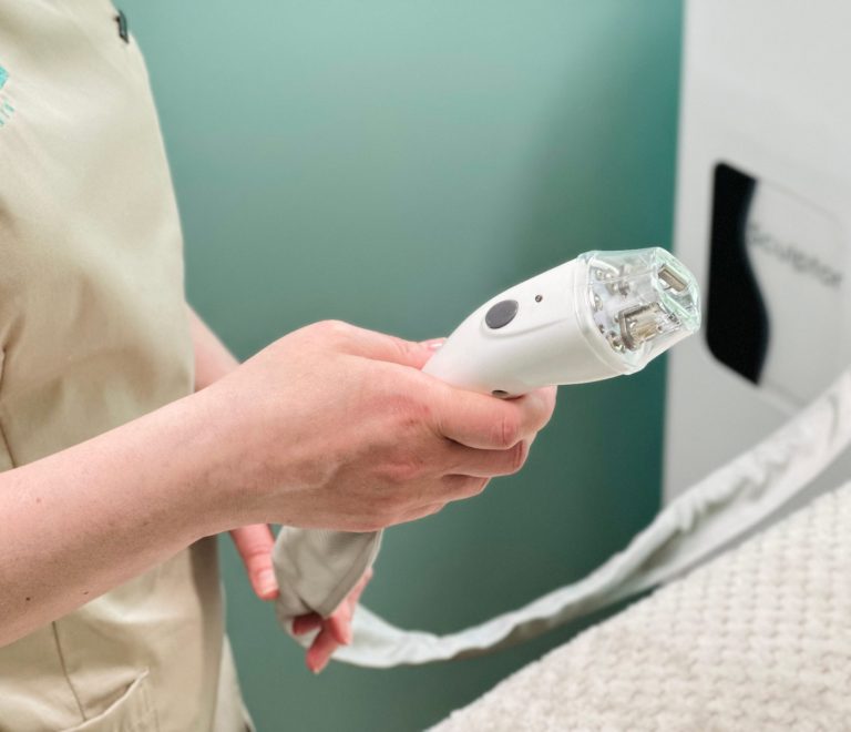 Rf-lifting + vaakum (Velashape) näole